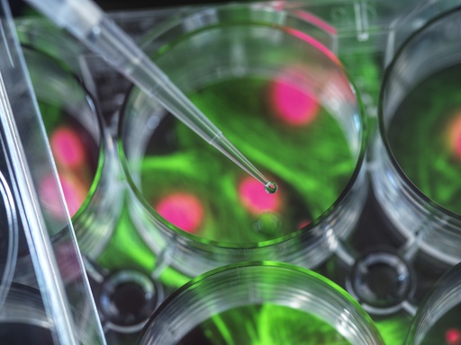 [SK-FLUO-196] Green Fluorescent Immortalized Human Umbilical Vein Endothelial Cells (HUVEC+GFP)