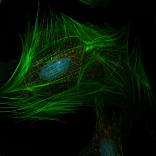 [SK-FLUO-201] Green Fluorescent Immortalized Human Astrocytes
