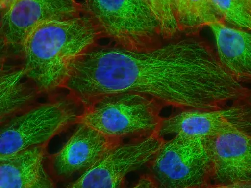 [SK-FLUO-202] Green Fluorescent Immortalized Human Aortic Endothelial Cells